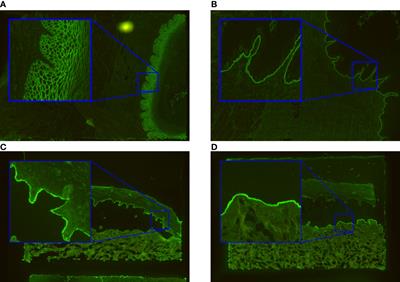 Computer-aided classification of indirect immunofluorescence patterns on esophagus and split skin for the detection of autoimmune dermatoses
